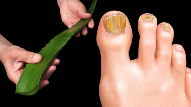 Questo semplice gesto con l’aloe vera trasforma la tua salute… scopri come!